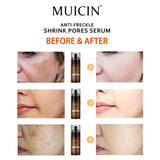 MUICIN - Anti Freckle Shrink Pores Serum - Clear & Confident Complexion