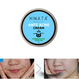 Hinata - Anti Acne Cream 29g