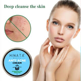 Hinata - Anti Acne Cream 29g