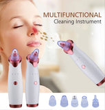 The Original Facial Beauty -Electric Blackhead Remover Pore Vacuum Suction Dermabrasion Face Cleaner Machine
