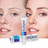 BIOAQUA- Acne Smoothing Cream