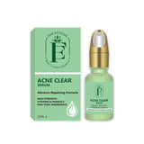 Fair Extreme Acne Clear Serum - 15ml