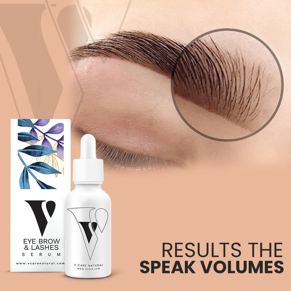 VCare Natural - Eye Brows & Lashes Serum 30ml