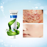 Shein- Anti-acne Dispel Scars Gel, 20 g